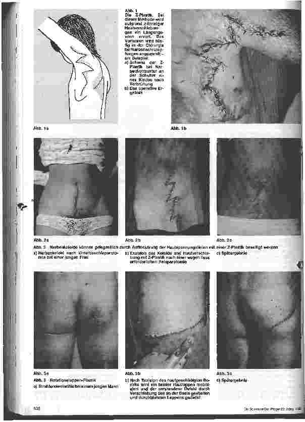 Vorschauseite 2: Chirurgische Krankenpflege
