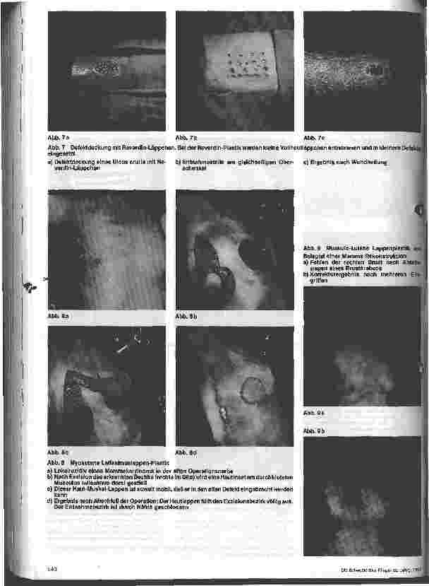 Vorschauseite 4: Chirurgische Krankenpflege