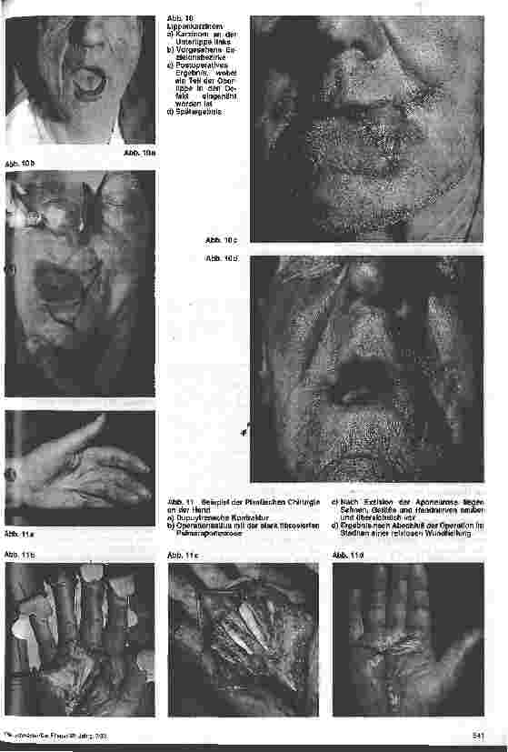 Vorschauseite 5: Chirurgische Krankenpflege