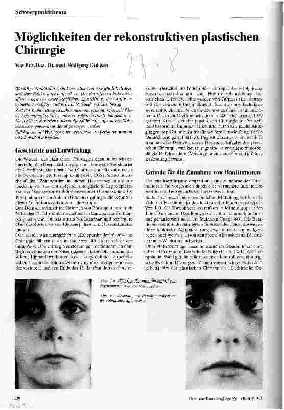 Vorschauseite 1: Möglichkeiten der rekonstruktiven plastischen Chirurgie