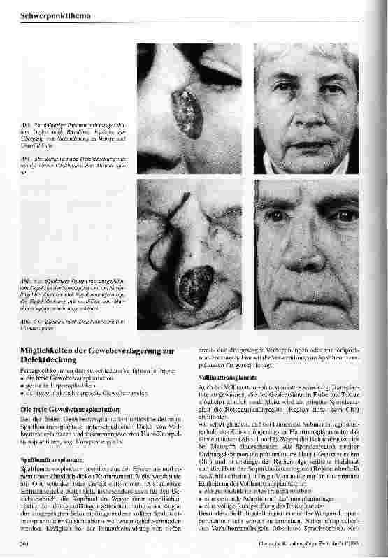 Vorschauseite 3: Möglichkeiten der rekonstruktiven plastischen Chirurgie