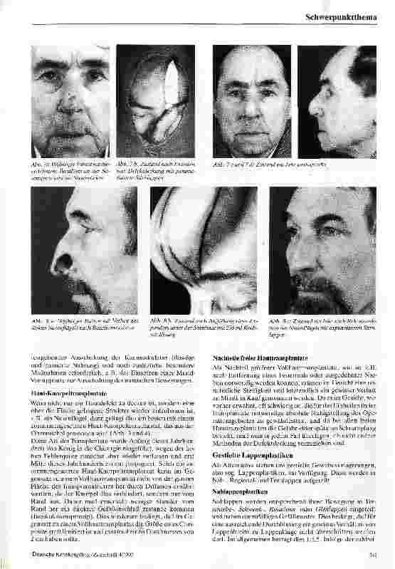 Vorschauseite 4: Möglichkeiten der rekonstruktiven plastischen Chirurgie
