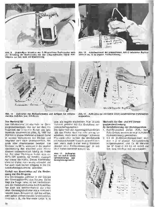 Vorschauseite 4: Transfusionskunde, Blutgruppenserologie und Immunhämatologie 27. Folge: Die Serumgruppen-Systeme Gm, InV, ISf,