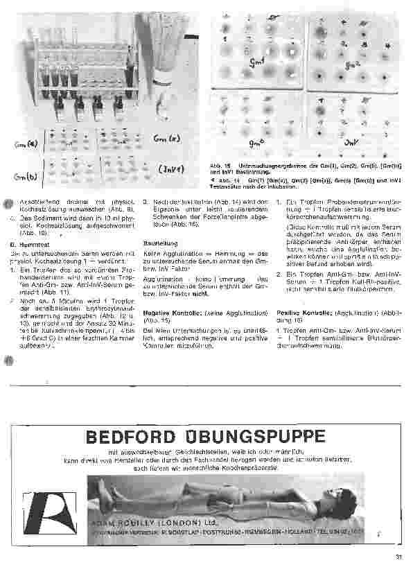 Vorschauseite 5: Transfusionskunde, Blutgruppenserologie und Immunhämatologie 27. Folge: Die Serumgruppen-Systeme Gm, InV, ISf,