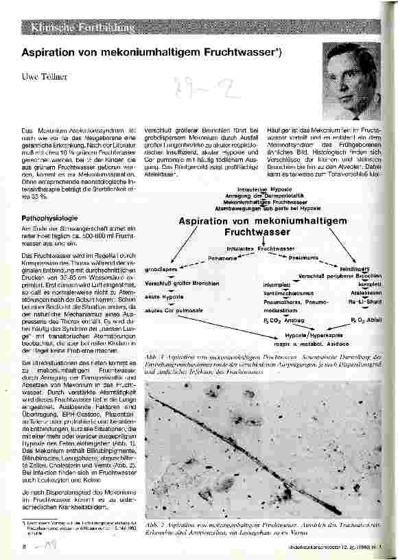 Vorschauseite 1: Aspiration von mekoniumhaltigem Fruchtwasser