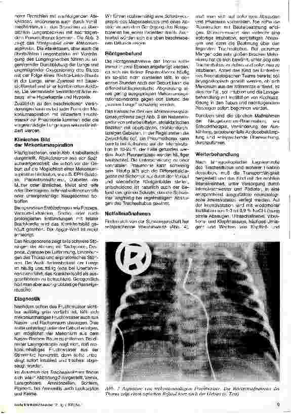 Vorschauseite 2: Aspiration von mekoniumhaltigem Fruchtwasser