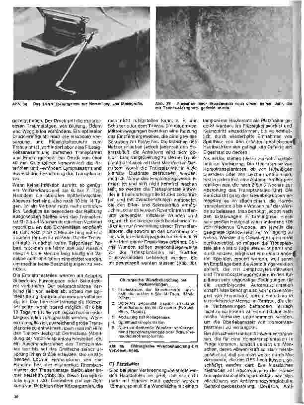 Vorschauseite 3: Die Verbrennungskrankheit und ihre Behandlung (Schluß)