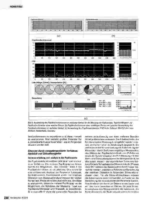 Vorschauseite 4: Aspekte der computergestützten Datenverarbeitung und Datenanalyse am Beispiel der Pupillometrie