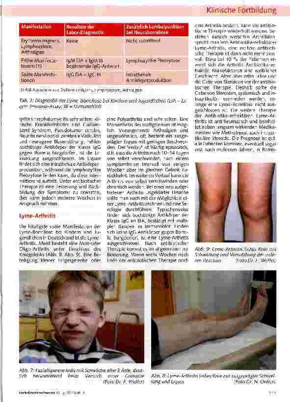 Vorschauseite 4: Die Lyme-Borreliose bei Kindern und Jugendlichen