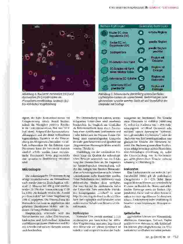Vorschauseite 5: Nützliche Urinuntersuchung