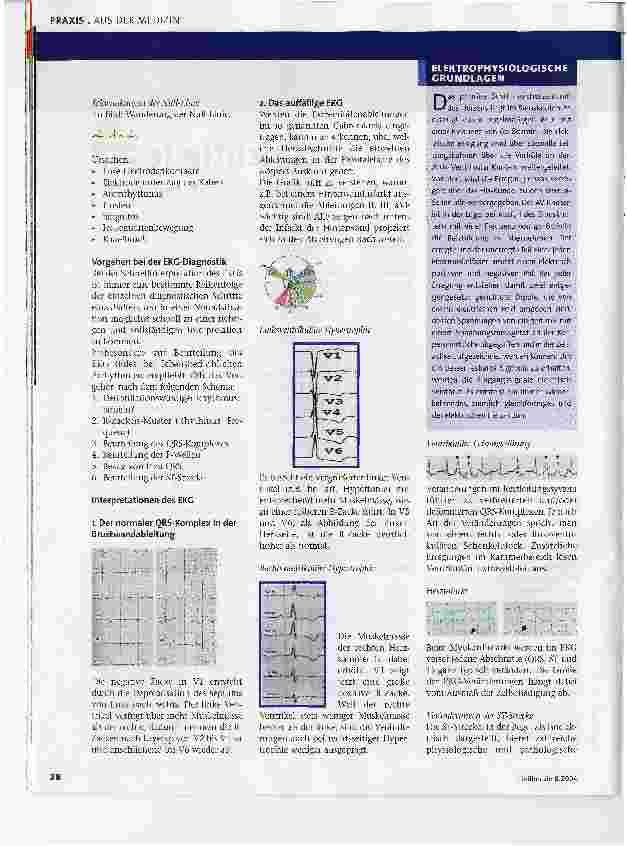 Vorschauseite 2: Ein EKG richtig lesen