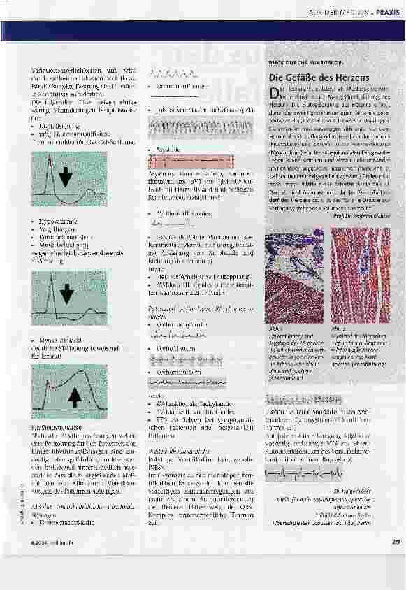 Vorschauseite 3: Ein EKG richtig lesen