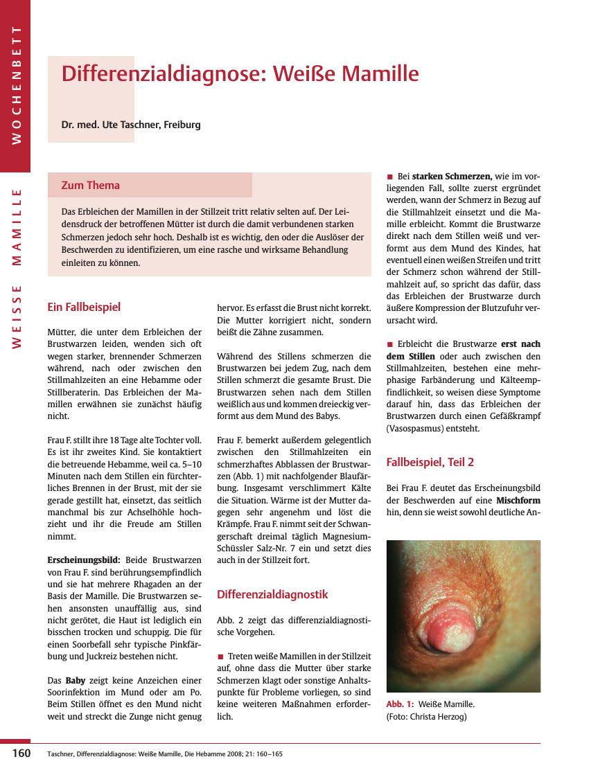 Vorschauseite 1: Differenzialdiagnose: Weiße Mamille