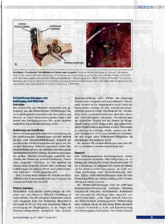 Vorschauseite 4: Entwicklungsstörungen des Ohres bei Kindern und Jugendlichen