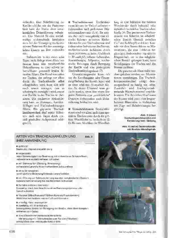 Vorschauseite 3: SICHERE ATMUNG ÜBER TRACHEOSTOMA