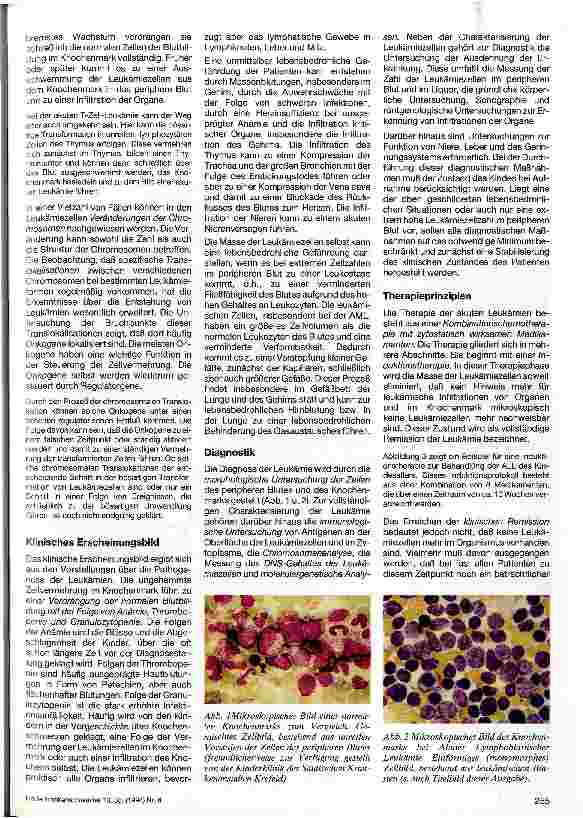 Vorschauseite 2: Leukämien im Kindesalter
