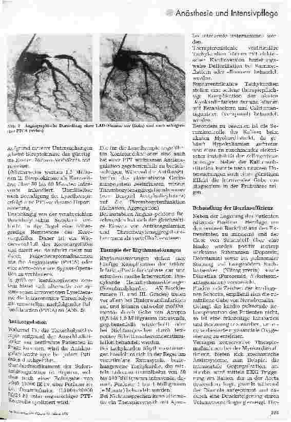 Vorschauseite 2: Herzinfarkt Pflegerische Betreuung und spezielle Therapie