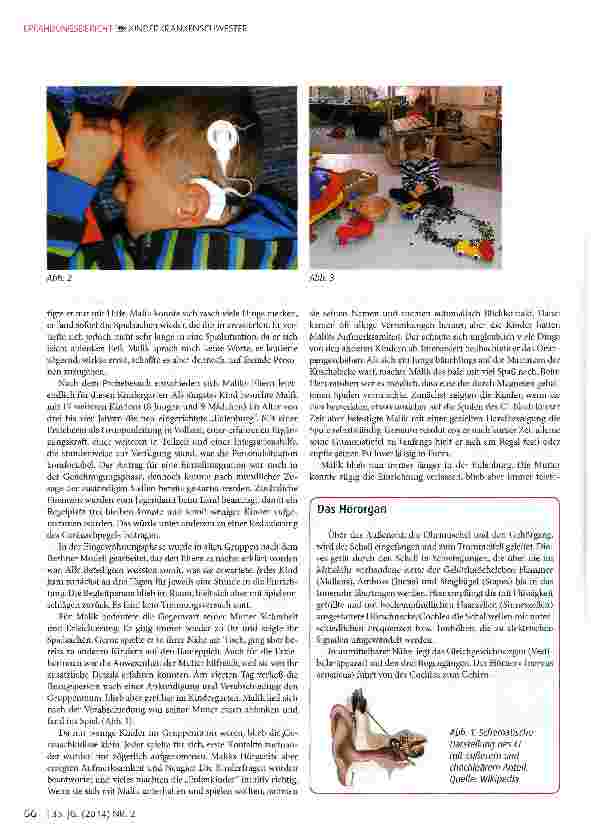 Vorschauseite 2: Geglückte Inklusion eines schwerhörigen Jungen mit Cochlea Implantatenin einem Regelkindergarten