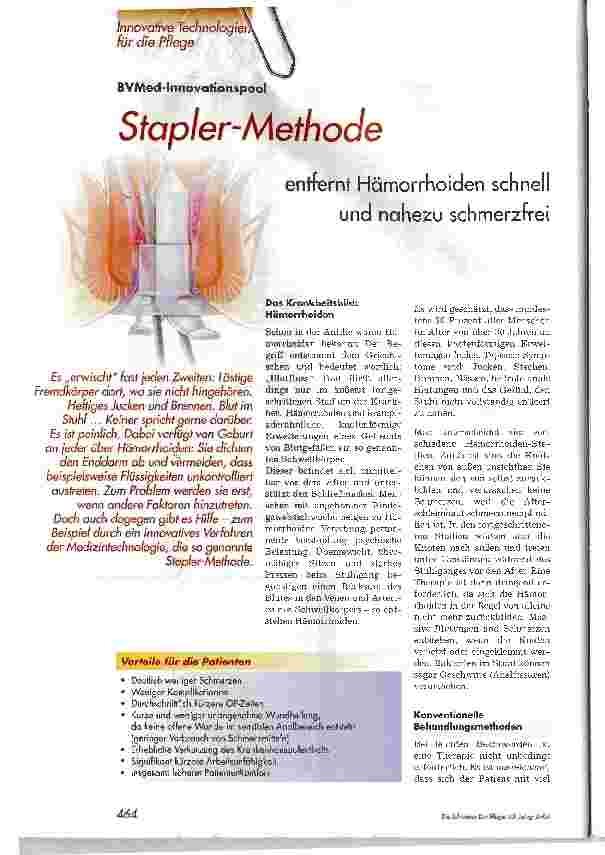 Vorschauseite 1: Stapler-Methodeentfernt Hämorrhoiden schnell und nahezu schmerzfrei
