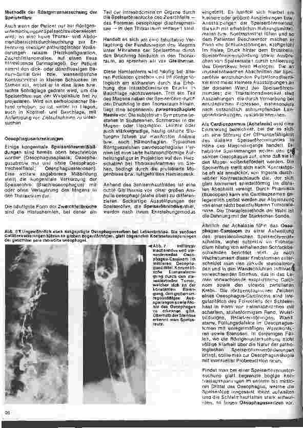 Vorschauseite 4: Radiologie Eine Einführung für Krankenschwestern u. Krankenpfleger 16. Folge: Röntgenuntersuchungen des Verdauungstraktes