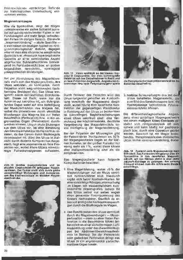 Vorschauseite 6: Radiologie Eine Einführung für Krankenschwestern u. Krankenpfleger 16. Folge: Röntgenuntersuchungen des Verdauungstraktes