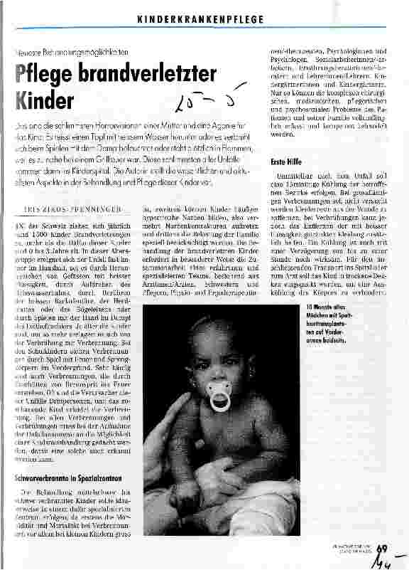 Vorschauseite 1: Pflege brandverletzter Kinder Neueste Behandlungsmöglichkeiten