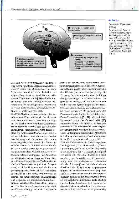 Vorschauseite 6: Allgemeinanästhesie - Was passiert im Gehirn unter Narkose?