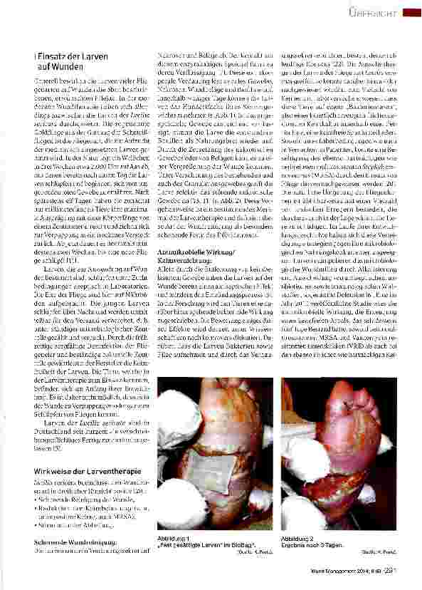Vorschauseite 3: Debridement mit medizinischen Larven - Ein Update