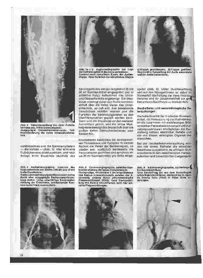 Vorschauseite 3: Radiologie Eine Einführung für Krankenschwestern u. Krankenpfleger 17. Folge: Angiologische Röntgenuntersuchungen