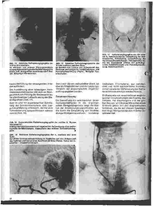 Vorschauseite 5: Radiologie Eine Einführung für Krankenschwestern u. Krankenpfleger 17. Folge: Angiologische Röntgenuntersuchungen