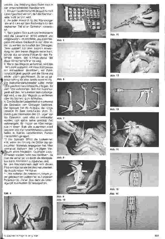 Vorschauseite 2: Handhabung der Klammerapparate aus der Sicht des OP.- Personals