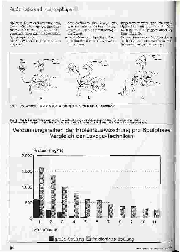 Vorschauseite 2: Therapeutische Lungenspülung bei Alveolarproteinose