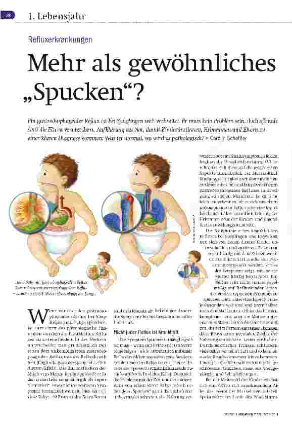 Vorschauseite 1: Mehr als gewöhnliches Spucken?