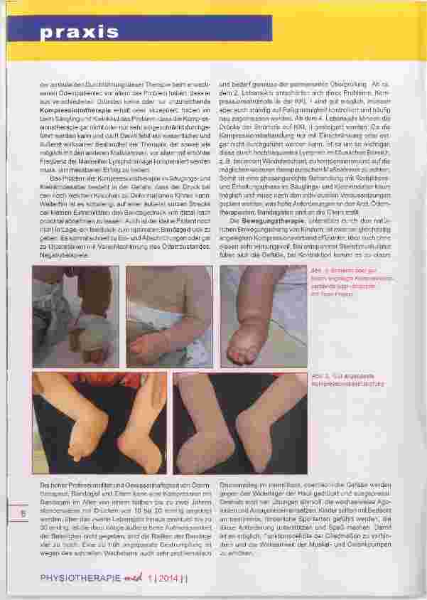 Vorschauseite 4: Physikalische Ödemtherapie im Kindesalter