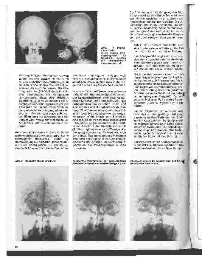 Vorschauseite 3: Radiologie Eine Einführung für Krankenschwestern u. Krankenpfleger 20. Folge: Neuroradiologie