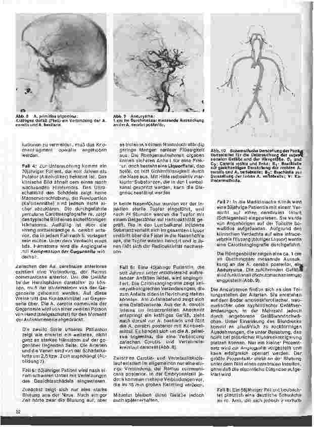 Vorschauseite 4: Radiologie Eine Einführung für Krankenschwestern u. Krankenpfleger 20. Folge: Neuroradiologie