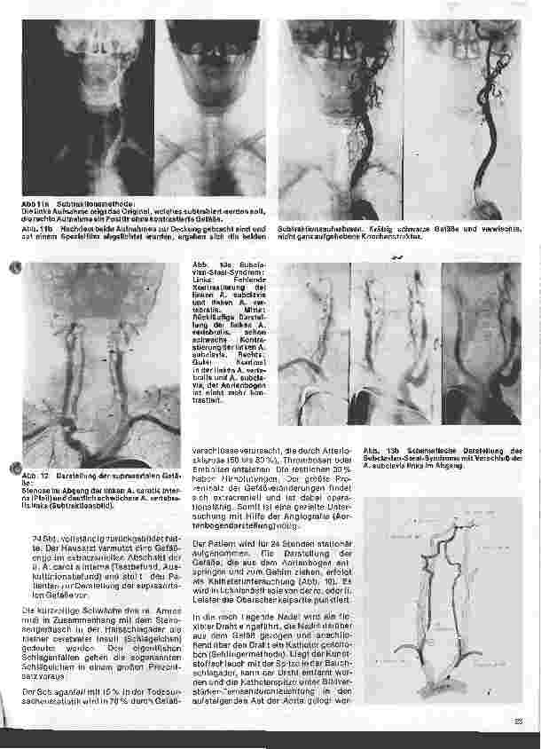 Vorschauseite 5: Radiologie Eine Einführung für Krankenschwestern u. Krankenpfleger 20. Folge: Neuroradiologie