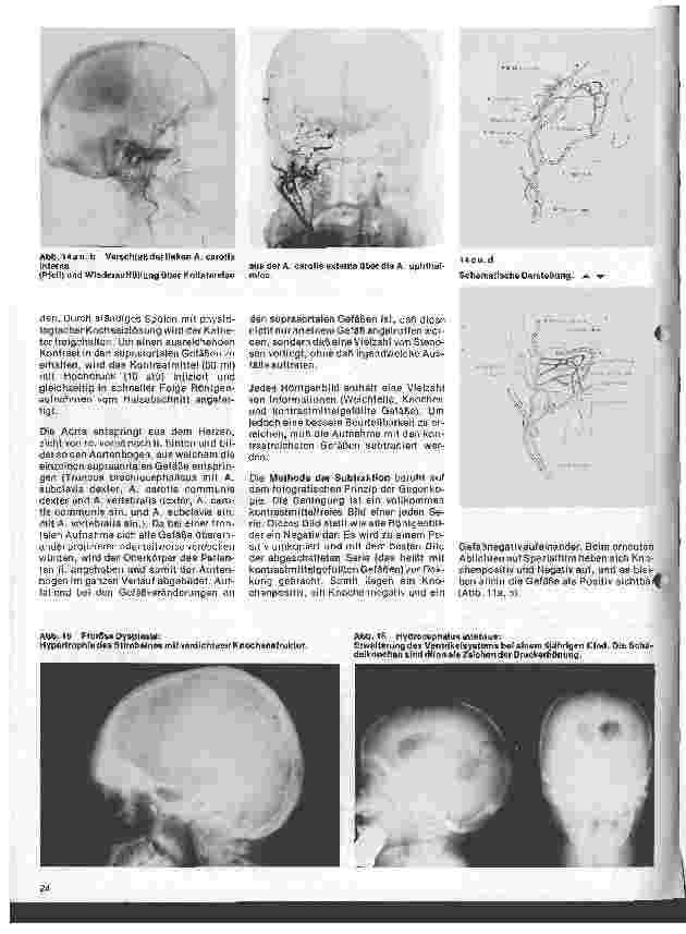Vorschauseite 6: Radiologie Eine Einführung für Krankenschwestern u. Krankenpfleger 20. Folge: Neuroradiologie