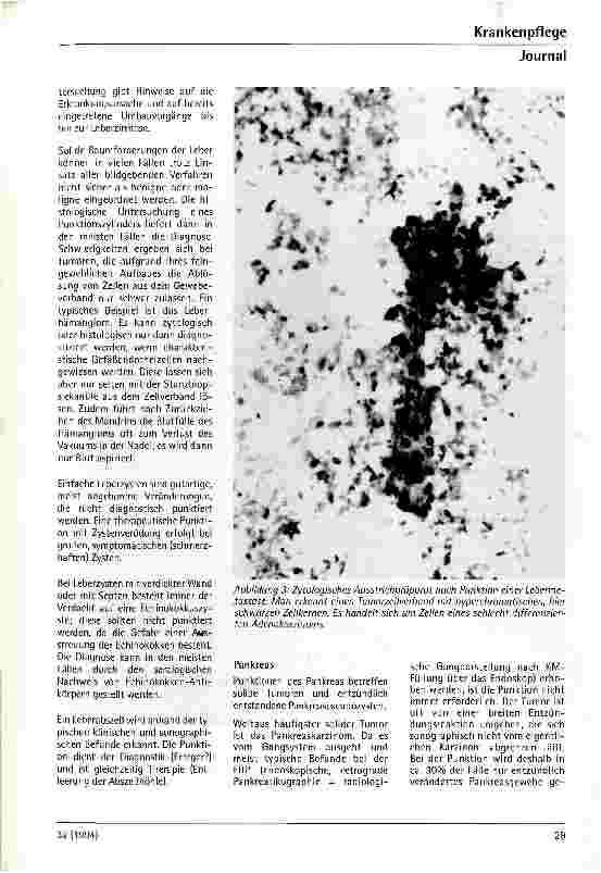 Vorschauseite 4: Welche klinische Bedeutung hat die ultraschallgezielte Feinnadelpunktion?