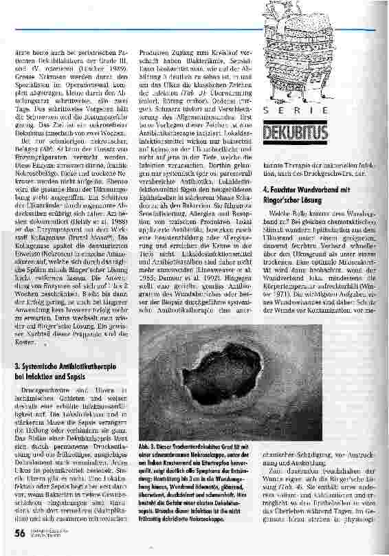 Vorschauseite 4: Therapie von Dekubiti