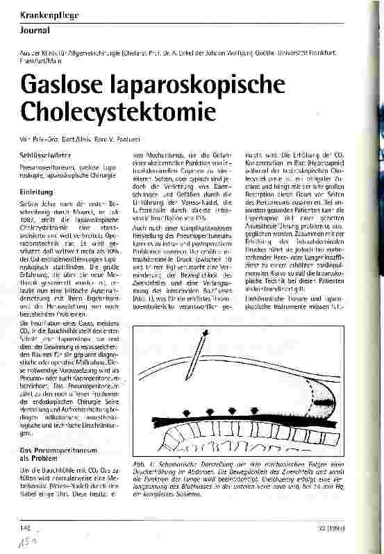Vorschauseite 1: Gaslose laparoskopische Cholecystektomie