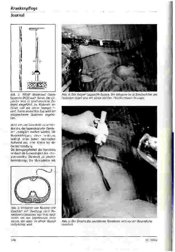 Vorschauseite 2: Gaslose laparoskopische Cholecystektomie