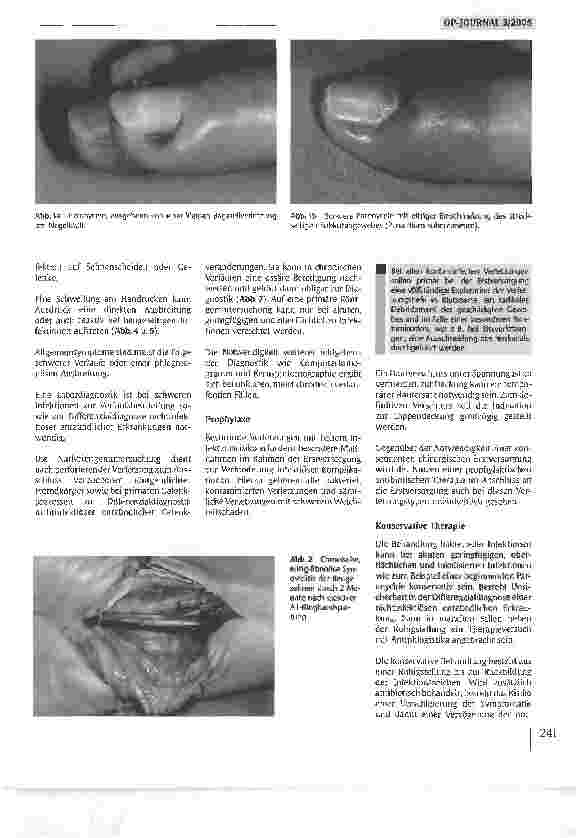 Vorschauseite 2: Infektionen an der Hand