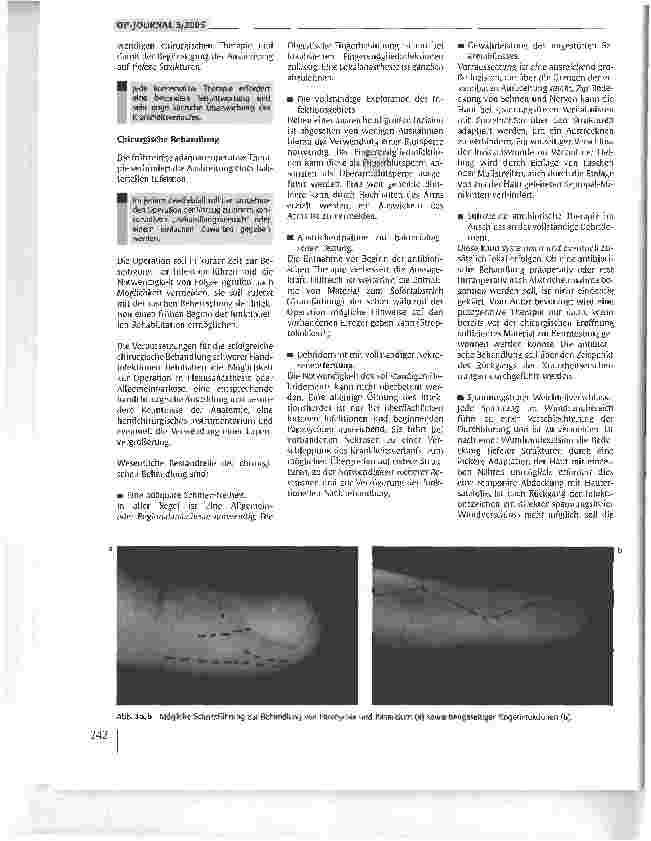Vorschauseite 3: Infektionen an der Hand