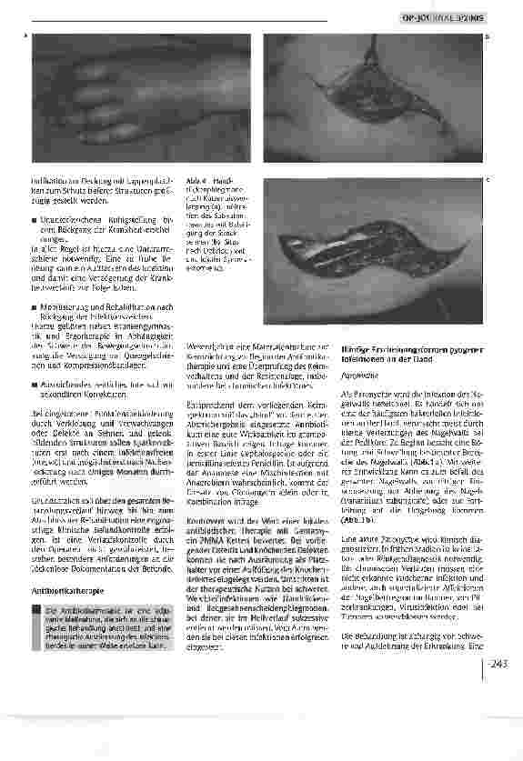 Vorschauseite 4: Infektionen an der Hand