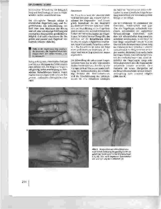 Vorschauseite 5: Infektionen an der Hand