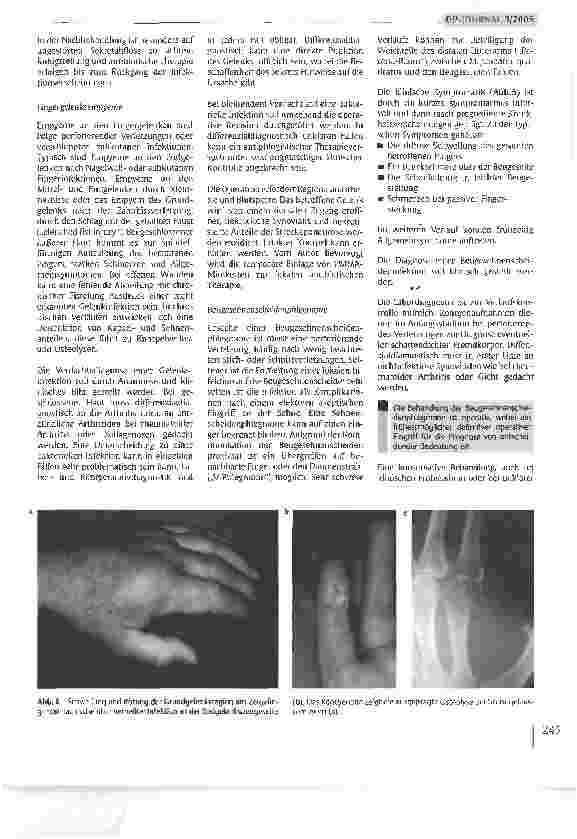 Vorschauseite 6: Infektionen an der Hand