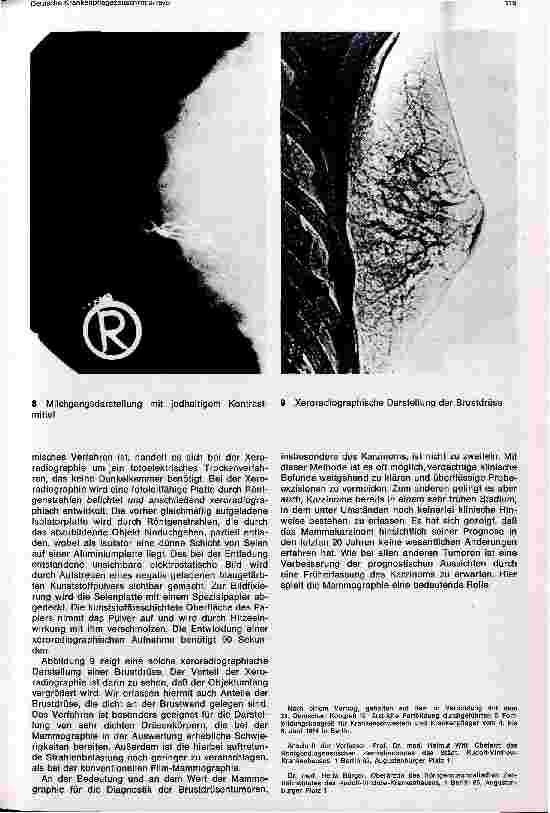 Vorschauseite 5: Die Röntgendiagnostik der Mamma in der Vorsorgeuntersuchung