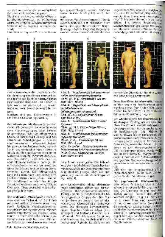 Vorschauseite 2: Minderwuchs im Kindesalter