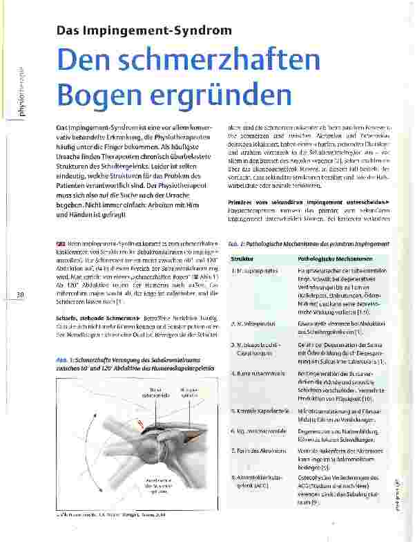 Vorschauseite 1: Das Impingement-Syndrom Den schmerzhaften Bogen ergründen